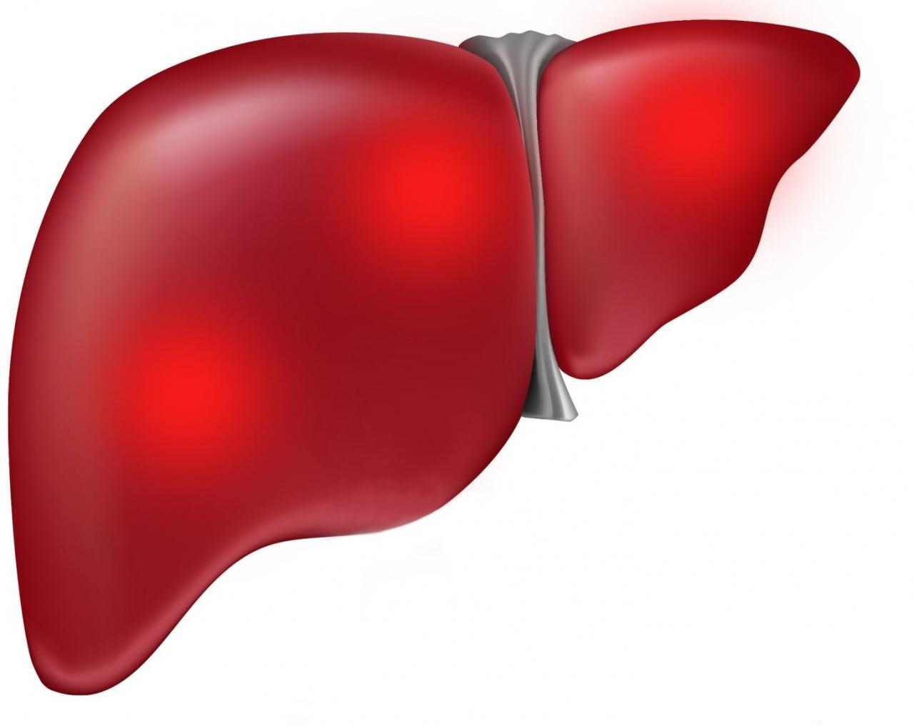 Гепатомегалия: причины развития, симптомы и методы терапии