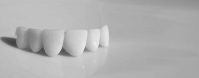 Как ставят коронку на зуб: этапы процедуры