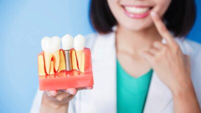 Показания к имплантации зубов