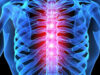 Зачем делают МРТ грудного отдела позвоночника и что оно покажет?