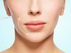 Плазмолифтинг лица: что за процедура
