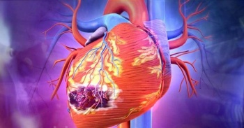 Современные методы диагностики инфаркта