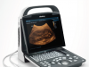 Портативные УЗИ аппараты: преимущества и критерии выбора