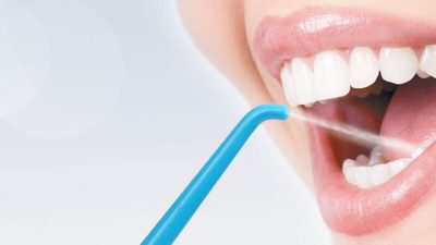 Чистка зубов Air Flow: особенности и достоинства метода