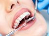 Забота о здоровье зубов: стоматологический центр Dental Park в Казахстане