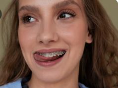 Как исправить прикус за короткий срок?